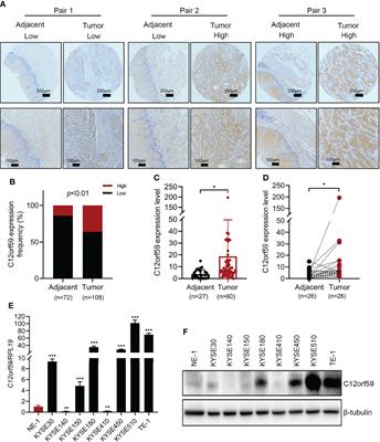 C12orf59 Promotes Esophageal Squamous Cell Carcinoma Progression via YAP-Mediated Epithelial-Mesenchymal Transition